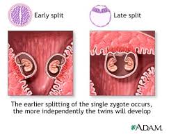 We did not find results for: Sarcina Multipla Cu Gemeni Sau Tripleti Poze Video