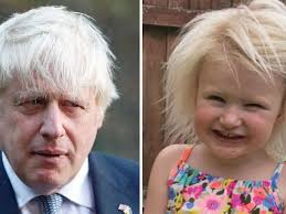 Tot with rare condition that leaves her unable to COMB her hair compared to  Boris Johnson