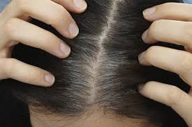 What causes grey or white hair? We Finally Know Why Stress Turns Your Hair White