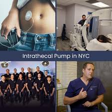 Image result for Intrathecal Pump