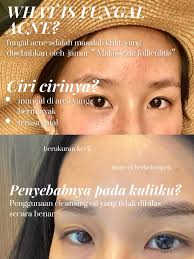 18 ide Felaufee Shampo teratas di 2024