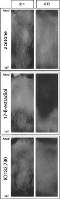 We recommend pura d'or organic argan oil conditioner known for preventing hair loss and reversing the effects of early hair loss. Topical Estrogen Accelerates Hair Regrowth In Mice After Chemotherapy Induced Alopecia By Favoring The Dystrophic Catagen Response Pathway To Damage Sciencedirect