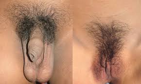 Since it has to regrow the whole root, you get extra time between male grooming sessions. Pubic Hair Simple English Wikipedia The Free Encyclopedia