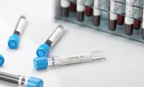 Who first learned of this new virus on 31 december 2019, following a report of a cluster of cases of 'viral pneumonia' in wuhan, people's republic of china. Ø±Ø¤Ù‰ Ø­ÙˆÙ„ ÙÙŠØ±ÙˆØ³ ÙƒÙˆÙÙŠØ¯ 19 ÙˆØ£Ù…Ø±Ø§Ø¶ Ø§Ù„ÙƒØ¨Ø¯ Ø¬Ø§Ù…Ø¹Ø© Ø­Ù…Ø¯ Ø¨Ù† Ø®Ù„ÙŠÙØ©