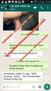 Tentang kami kami siap mengerjakan proyek bangunan kontruksi baja, tralis, pagar,canopy dll. Ukuran Mr P 20 Cm Pengobatan Alat Vital Bogor H Muh Yusuf Dan Mbah Udin Sidik P Anda Terlihat Lebih Besar 3