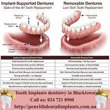 Payment Options For Implants Dentistry Blacktown Affordable Implants Implant Dentistry Dental Implants Cost Dental