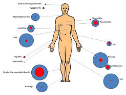 There are three primary types of skin cancer. Investigating The Side Effects Of Cancer Immunotherapy National Cancer Institute