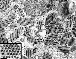 Modern Uses Of Electron Microscopy For Detection Of Viruses Clinical Microbiology Reviews This image series offers an incredible look at some of the world's most dangerous viruses and bacteria. modern uses of electron microscopy for