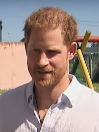 Prince Harry's Hair Transplant – Did It ...