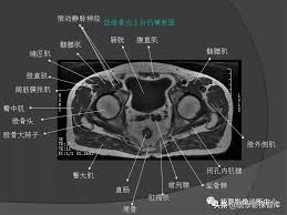 We did not find results for: Mri Anatomy Of Pelvic Muscles Inews