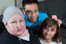 Party time for brave little Skyla