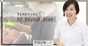 This is normal and nothing to worry about. Patient Mailbox I Wish To Remove My Bcg Keloid Scar On My Arm Peter Ch Ng Skin Specialist Kl Malaysia