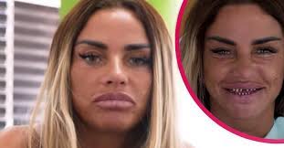Katie price compared herself to bond villain jaws while showing off her real teeth ahead of a veneer replacement. Katie Price Suffers Missing Veneers On Holiday Entertainment Daily