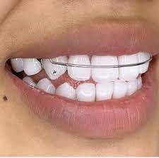 Tooth Gem Halo Beauty Collective Tooth Gem Halo Beauty Teeth Jewelry