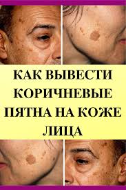 как быстро избавиться от пятен после прыщей на лице Kak Vyvesti Korichnevye Pyatna Na Kozhe Lica Health And Beauty Health Skin Care