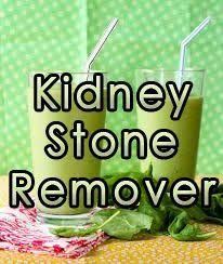 Remedies For Kidney Stones Healthybuzzer Com Kidney Stones Remedy Remedies Holistic Health