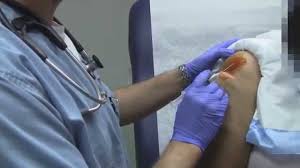 Image result for Subacromial Space Injection