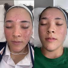 Learning from difficult horses in horse riding journey