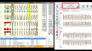 dental charting with voiceworks