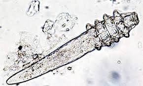Image result for Demodex brevis