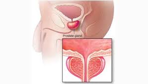 Penting lho untuk mengetahui g spot wanita. Kelenjar Prostat Pengertian Fungsi Struktur Bagian