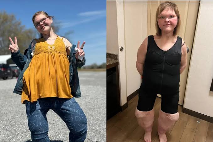 1000-Lb. Sisters star Tammy Slaton is unrecognizable in new photos after  500-pound weight loss - Yahoo Life UK