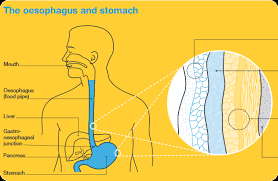 Symptoms of early stomach cancer can be similar to the symptoms of other conditions, such as stomach ulcers. Stomach And Oesophageal Cancer Overview Cancer Council Victoria