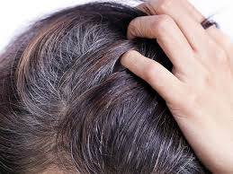 La colorazione ai capelli permette di sfoggiare la chioma come meglio si desidera, bionda, rossa, nera e così via. I Capelli Grigi Non Esistono Naturelab