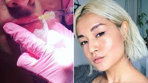We did not find results for: I Got Lip Fillers For The First Time Before And After Photos Allure