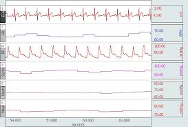 cardiovascular hemodynamics research biopac