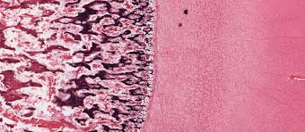 The image can be changed using any combination of the following commands. Bone And Bone Formation Histology