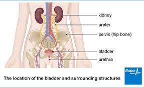 Kidney Stones Health Information Bupa Uk