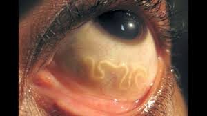 Insan Vucudunda Yasayabilen 7 Seytani Parazit Turu Youtube