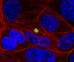 * the word cryptosporidium originates from latin word meaning underground spore. Combining Forces To Alleviate The Burden Of Cryptosporidium Path