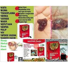 We did not find results for: Mustika Dara Hni Hpai Shopee Indonesia