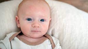Wissen zu neurodermitis bei baby & kind. Was Tun Bei Neurodermitis Bei Babys Und Kleinkindern Heimat Krankenkasse