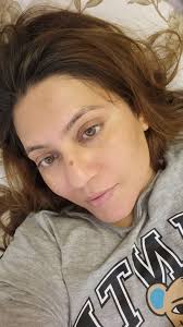 Lip pigmentation !!! Going to quit smoking for good this time , but how do  i fix my lip pigmentation problem? Is there any treatment to lighten the  lips , smoked for