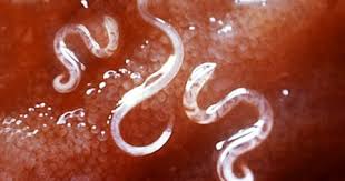 Image result for Hookworm
