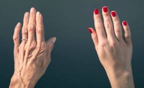 Remedios Para Atenuar O Eliminar Las Manchas En Las Manos