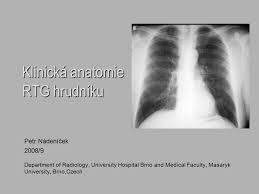 Ultrazvuk může zobrazit trombus v žilách dolních končetin, echokardiografické vyšetření může zobrazit přetížení pravé komory srdeční (v důsledku obstrukce plicnice). Klinicka Anatomie Rtg Hrudniku Ppt Stahnout