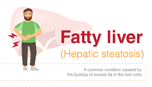 About the size of a football, it's located mainly in the upper right portion of your abdomen, beneath the diaphragm and above your stomach. Overview Of Fatty Liver Signs Symptoms And Diagnosis