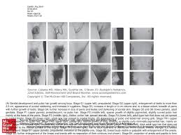 A Genital Development And Pubic Hair Growth Among Boys