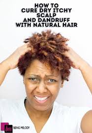 Natural hair care natural hair styles hair smoothening hair dandruff getting rid of dandruff shiny hair natural home remedies white wine easy hairstyles. How To Cure Dry Itchy Scalp And Dandruff With Natural Hair Www Beingmelody Com