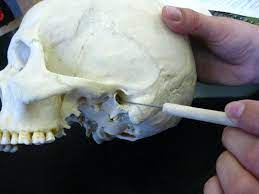 Sound waves cause the eardrum to. Boned Human Skull External Auditory Meatus Of Temporal Bone Human Skull Skull Skull Reference