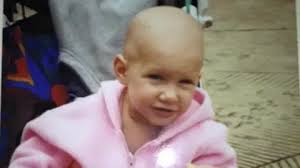 Am I the only one with hearing aids and alopecia?'