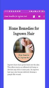For this, dissolve two aspirin in some water to make a fine paste. Download Home Remedies For Ingrown Hair Free For Android Home Remedies For Ingrown Hair Apk Download Steprimo Com