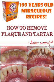 How do you pull out a tooth without any pain? Home Remedies To Remove Plaque And Tartar Beauty Tips Diary Teeth Health Health Remedies Dental Health