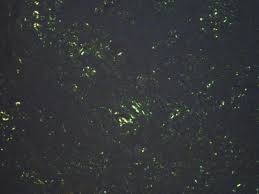 Amyloid refers to the abnormal, fibrous, extracellular proteinaceous deposits found in organs such as liver, kidneys, spleen etc. Amyloid Stain Kit