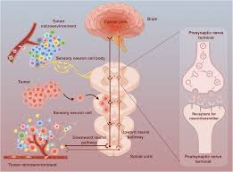 Image result for Cancer Pain