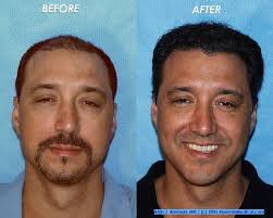 Hair Loss Treatment Center